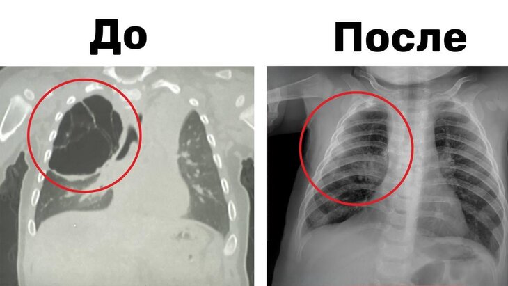 � ����������� ������� ������� 15-������������� ����� �������